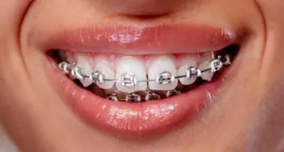 Pacjent Stomatologii i Ortodoncji